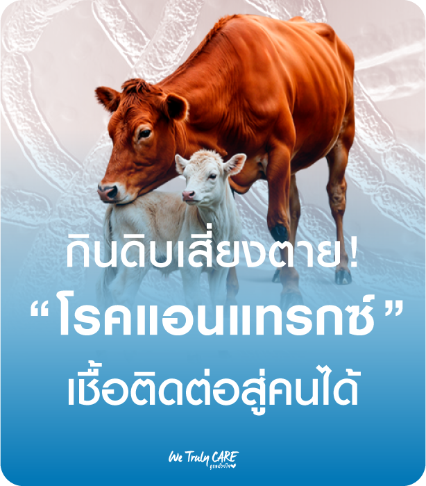 กินดิบเสี่ยงตาย จากโรคแอนแทรกซ์ (Anthrax) เชื้อติดต่อสู่คนได้